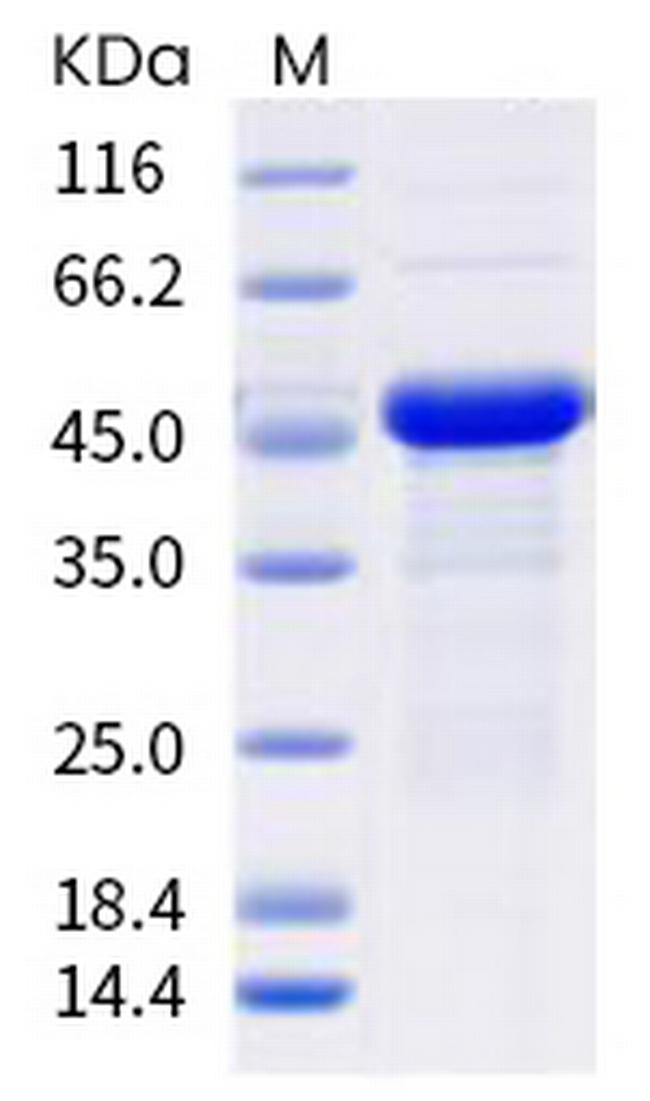 SARS-CoV-2 Nucleocapsid (I292T) His-tag Protein
