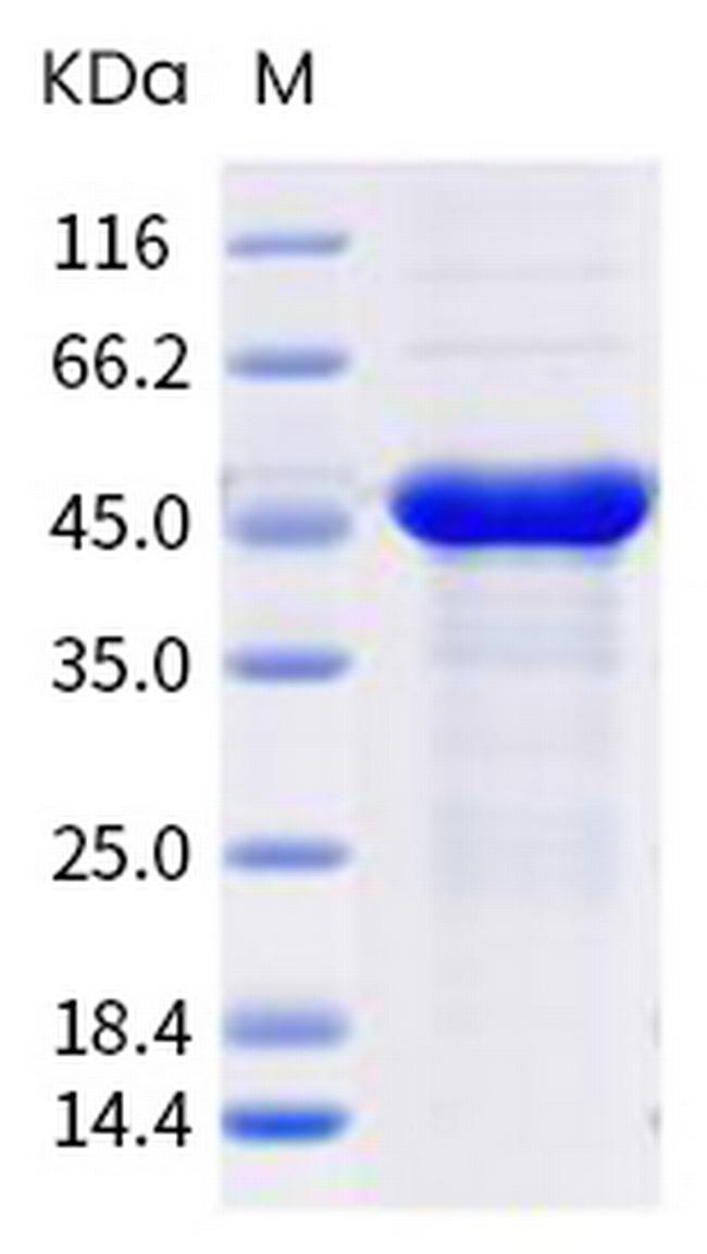 SARS-CoV-2 Nucleocapsid (P13L) His-tag Protein