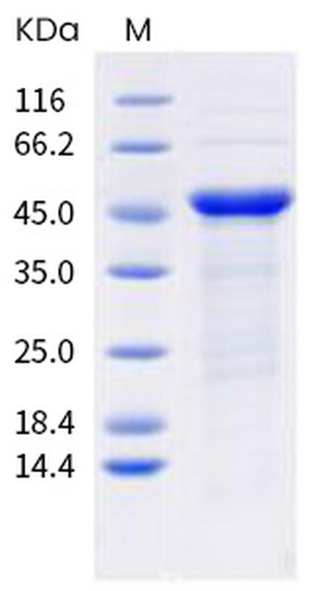 SARS-CoV-2 Nucleocapsid (mutant) His-tag Protein