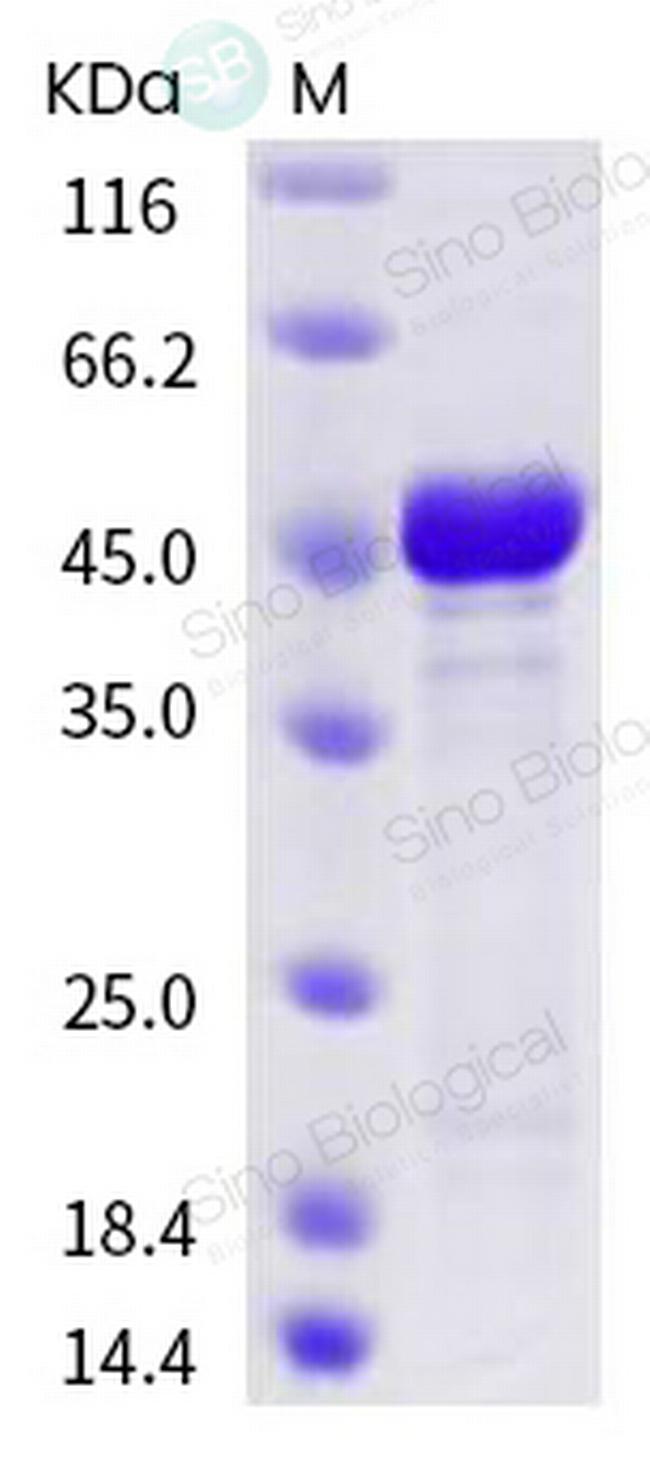 SARS-CoV-2 Nucleocapsid His-tag Protein