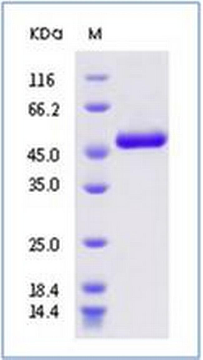 SARS-CoV-2 Nucleocapsid His-tag Protein