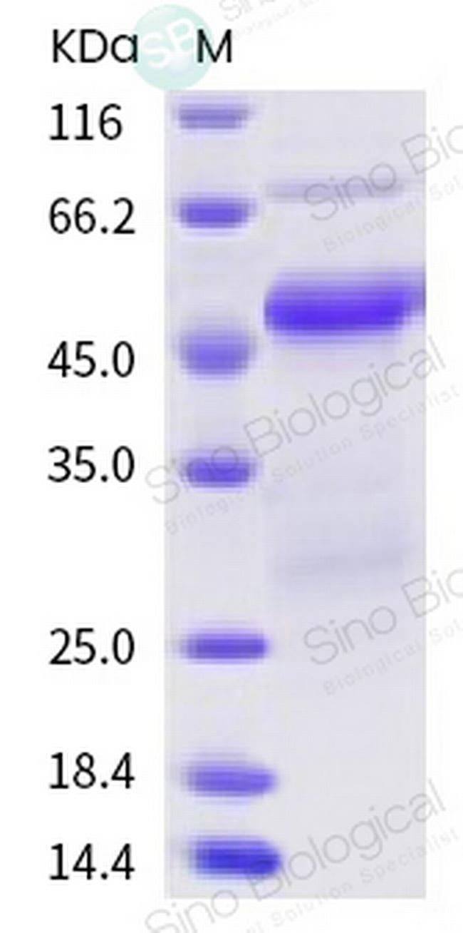 SARS-CoV-2 Nucleocapsid His-tag Protein