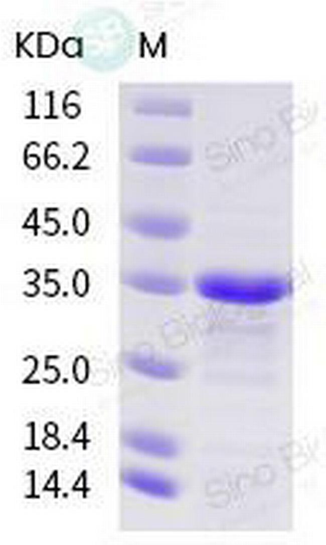 SARS-CoV-2 PLpro (aa 1564-1880) His-tag Protein