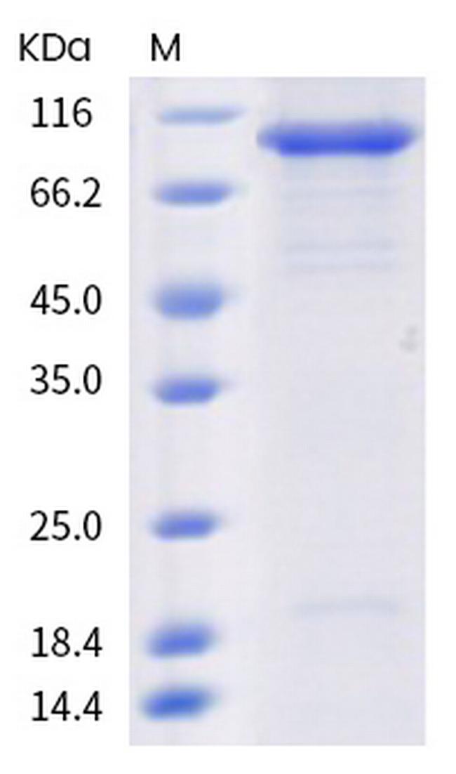 SARS-CoV-2 RDRP His-tag Protein