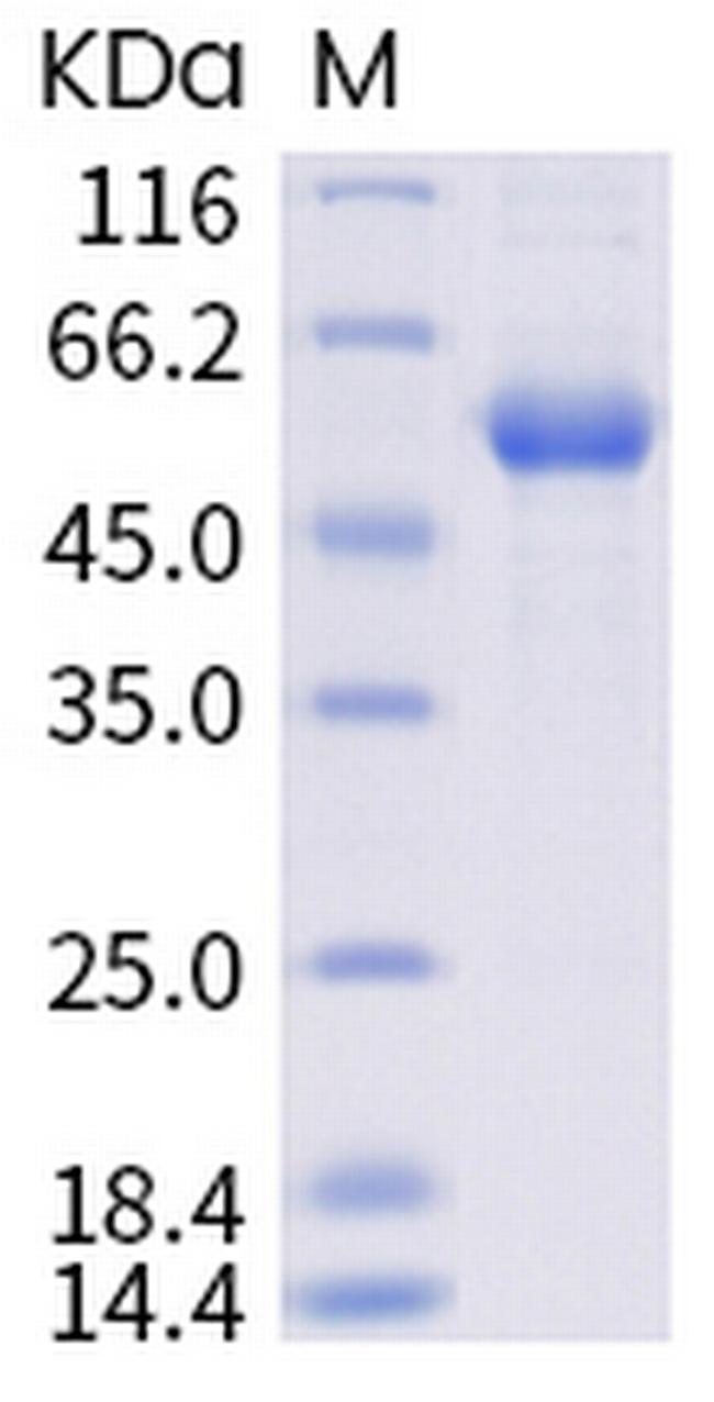 SARS-CoV-2 Spike Protein (RBD) (E484K) Fc Chimera Protein