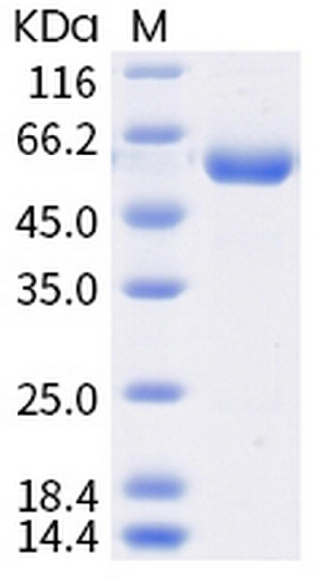 SARS-CoV-2 Spike Protein (RBD) (K417N) Fc Chimera Protein