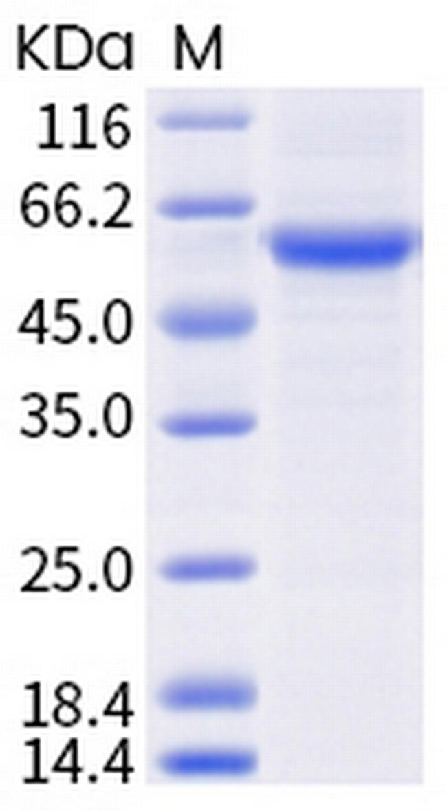 SARS-CoV-2 Spike Protein (RBD) (B.1.351) Fc Chimera Protein