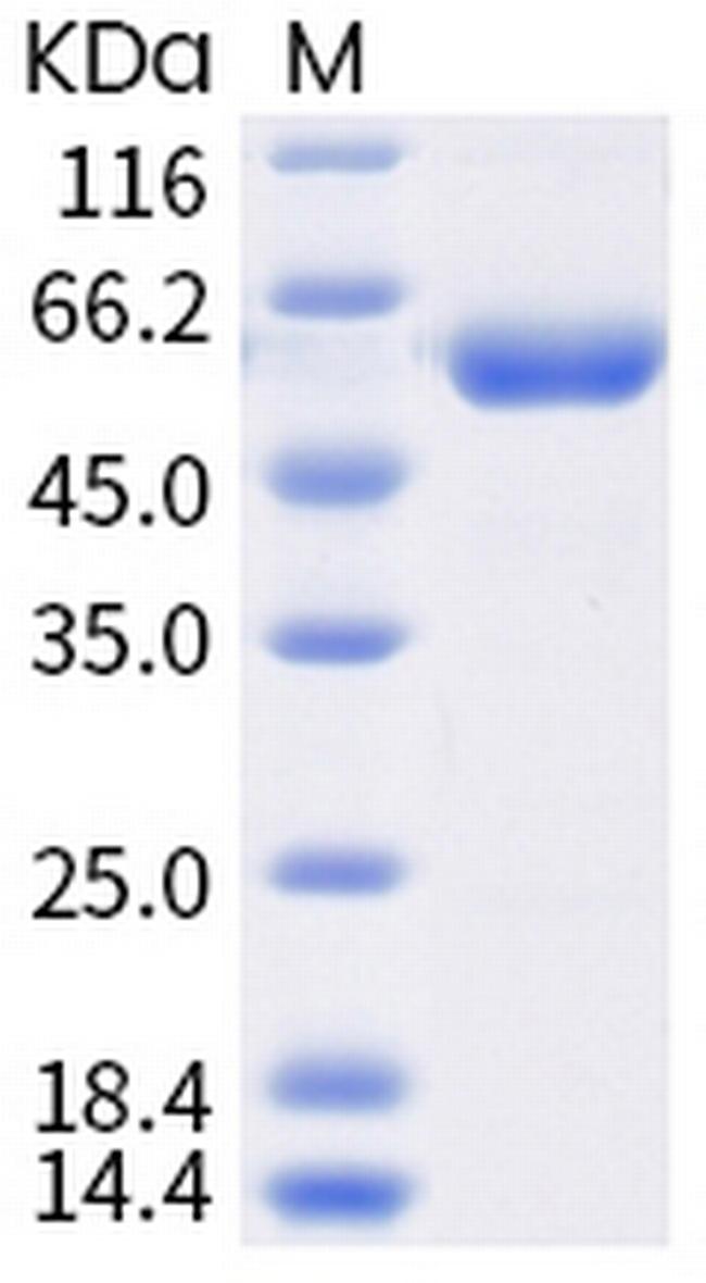 SARS-CoV-2 Spike Protein (RBD) (K417T) Fc Chimera Protein