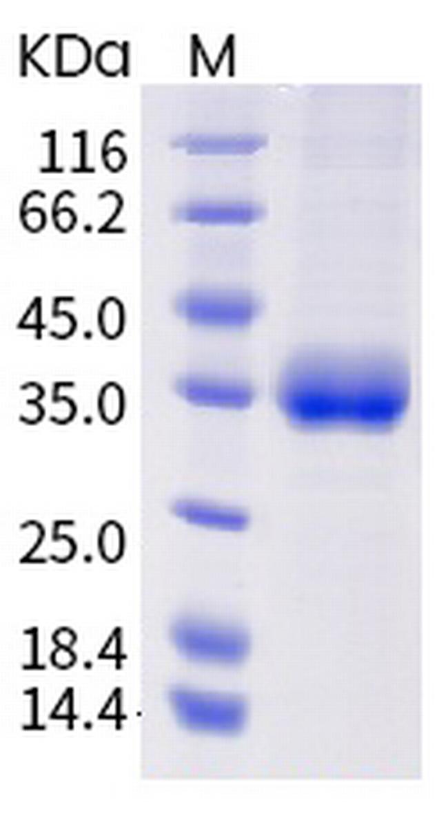 SARS-CoV-2 Spike Protein (RBD) (mutant) His-tag Protein