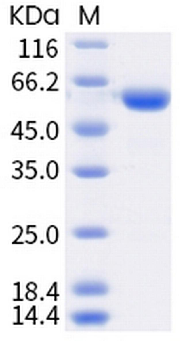 SARS-CoV-2 Spike Protein (RBD) (P.1) Fc Chimera Protein