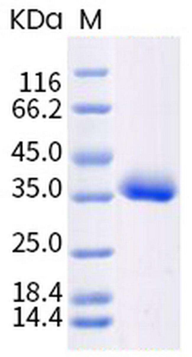 SARS-CoV-2 Spike Protein (RBD) (B.1.617) His-tag Protein