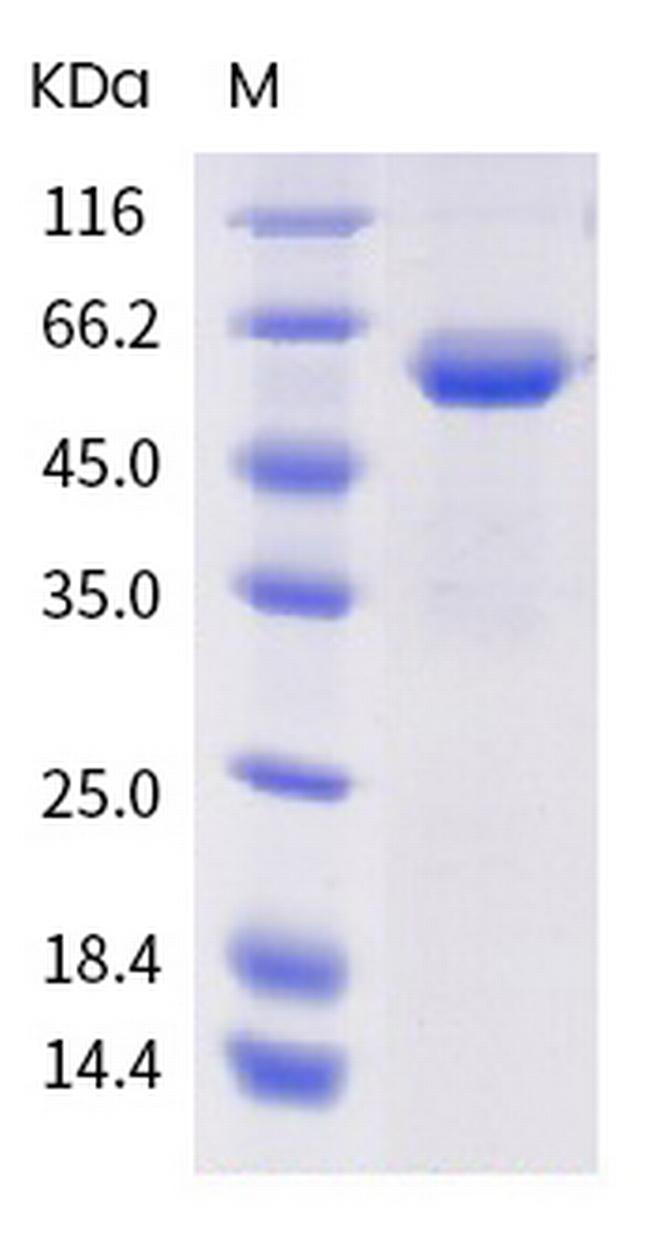 SARS-CoV-2 Spike Protein (RBD) (N501Y) Fc Chimera Protein