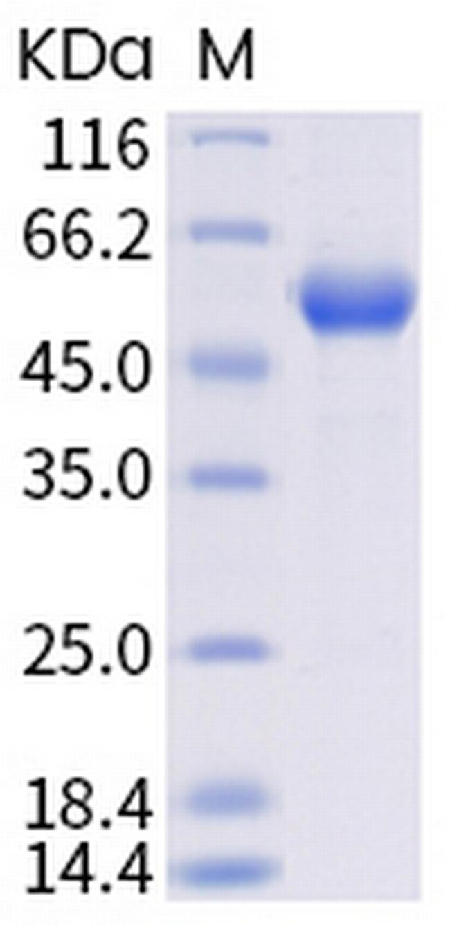 SARS-CoV-2 Spike Protein (RBD) (N501Y) Fc Chimera Protein