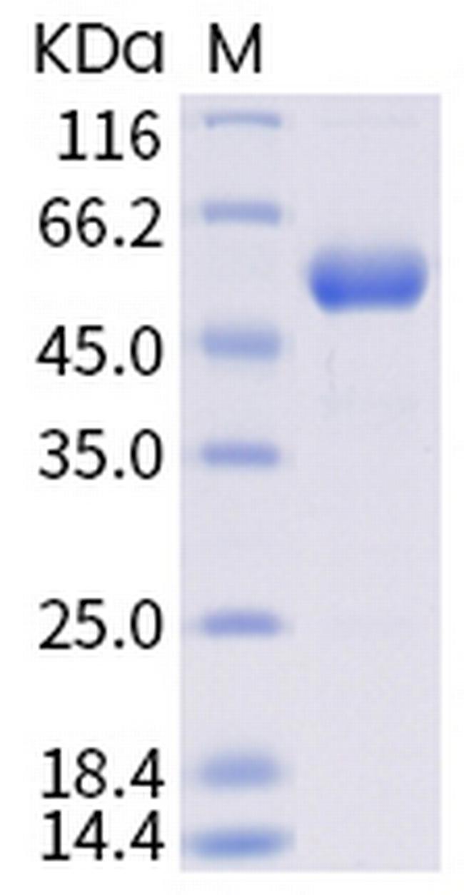 SARS-CoV-2 Spike Protein (RBD) (Y453F) Fc-tag Protein