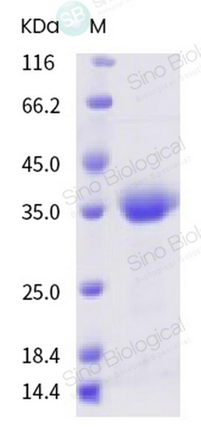 SARS-CoV-2 Spike Protein (RBD) Protein