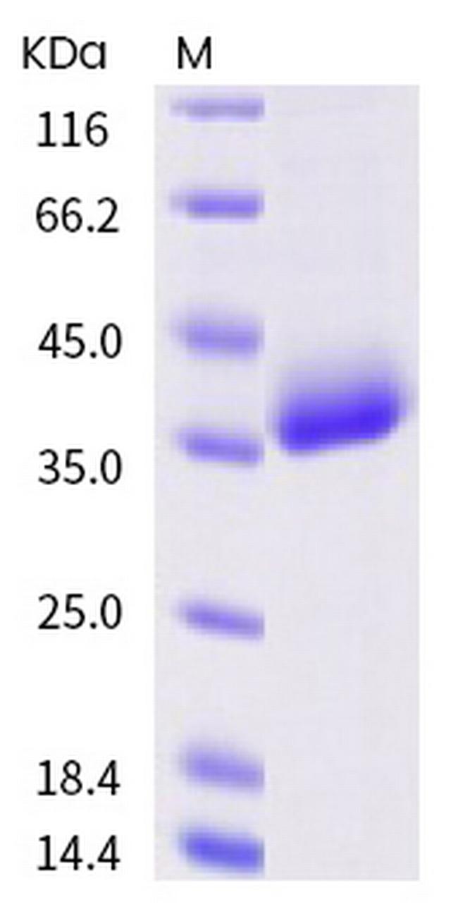 SARS-CoV-2 Spike Protein (RBD) (A344S) His-tag Protein