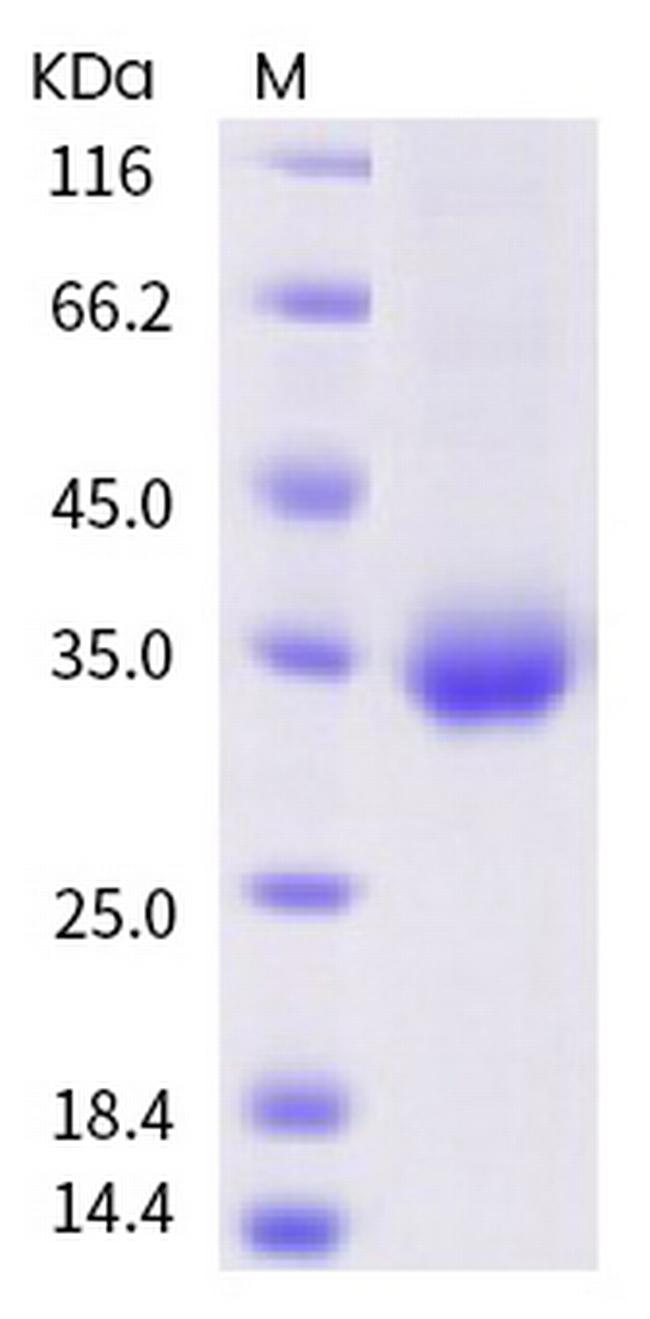 SARS-CoV-2 Spike Protein (RBD) (A348S) His-tag Protein