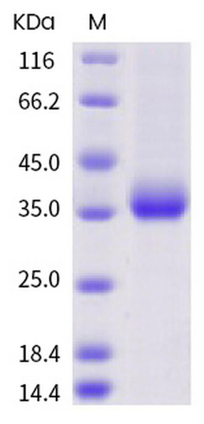 SARS-CoV-2 Spike Protein (RBD) (A352S) His-tag Protein