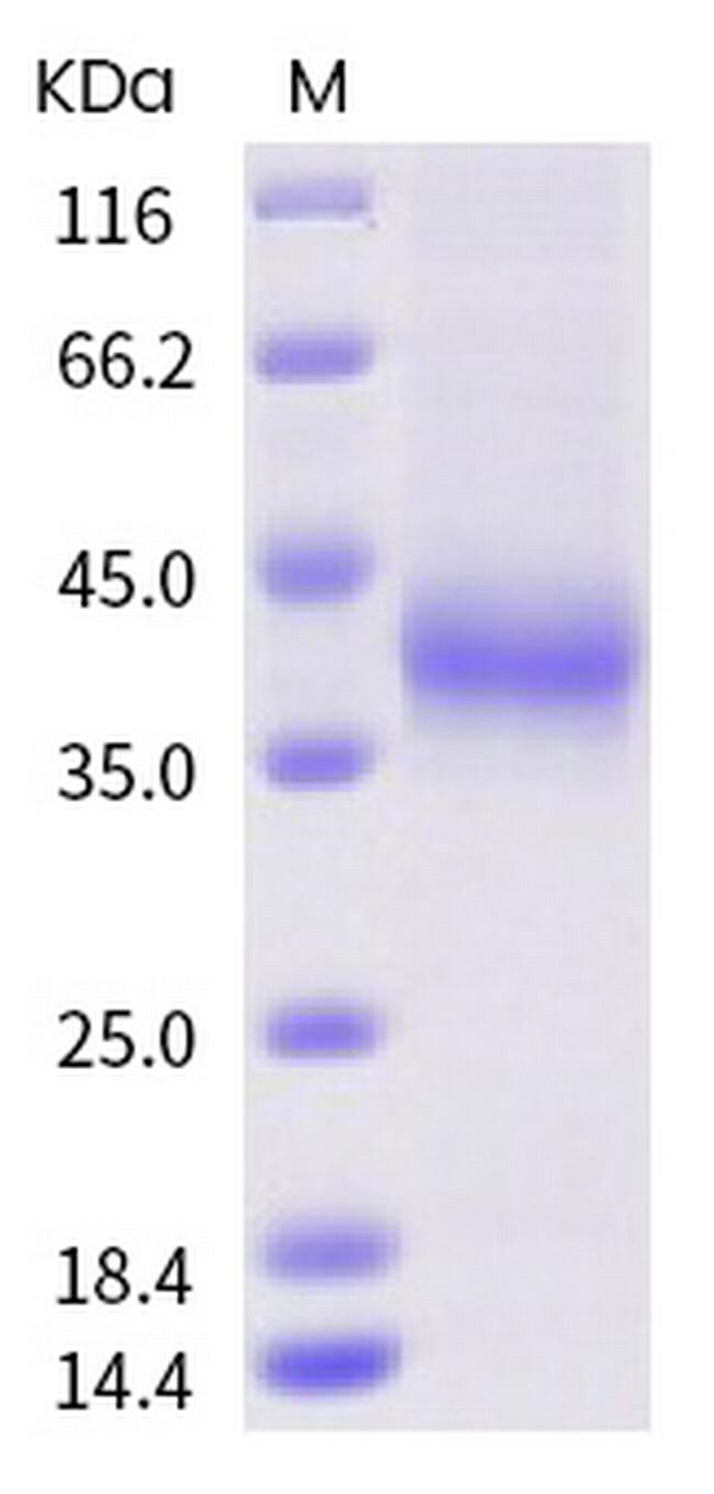 SARS-CoV-2 Spike Protein (RBD) (A372S) His-tag Protein