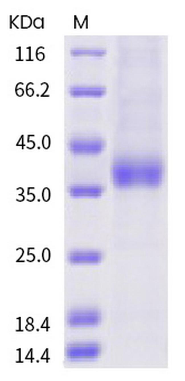 SARS-CoV-2 Spike Protein (RBD) (A372T) His-tag Protein