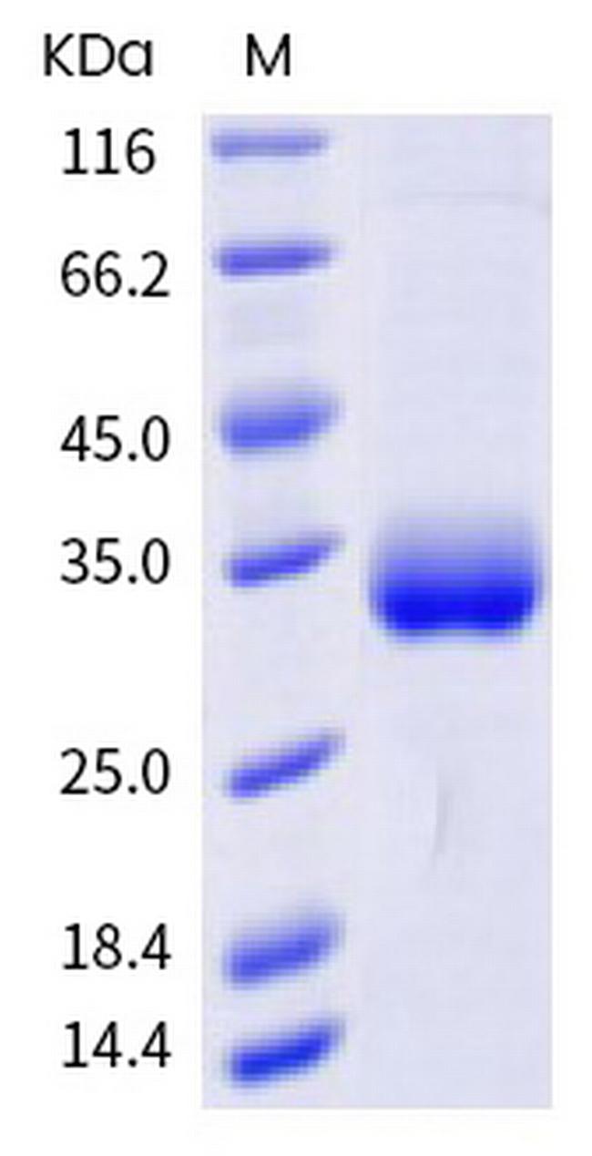 SARS-CoV-2 Spike Protein (RBD) (A475V) His-tag Protein