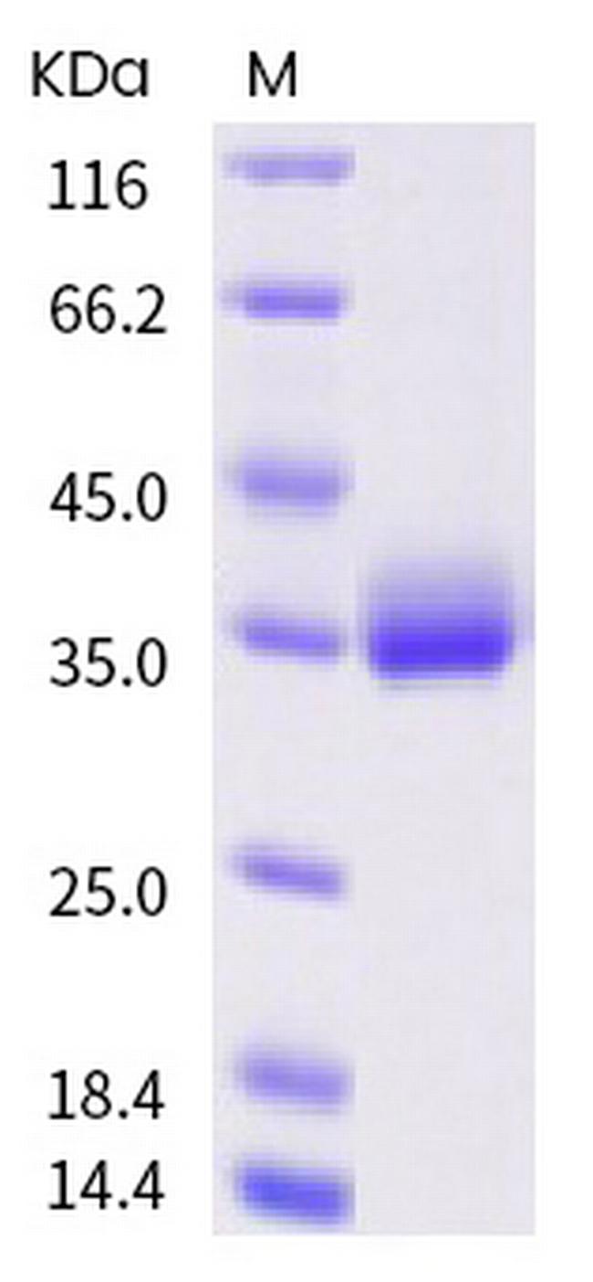 SARS-CoV-2 Spike Protein (RBD) (A520S) His-tag Protein