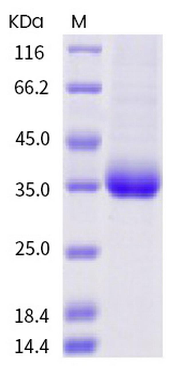 SARS-CoV-2 Spike Protein (RBD) (A520V) His-tag Protein