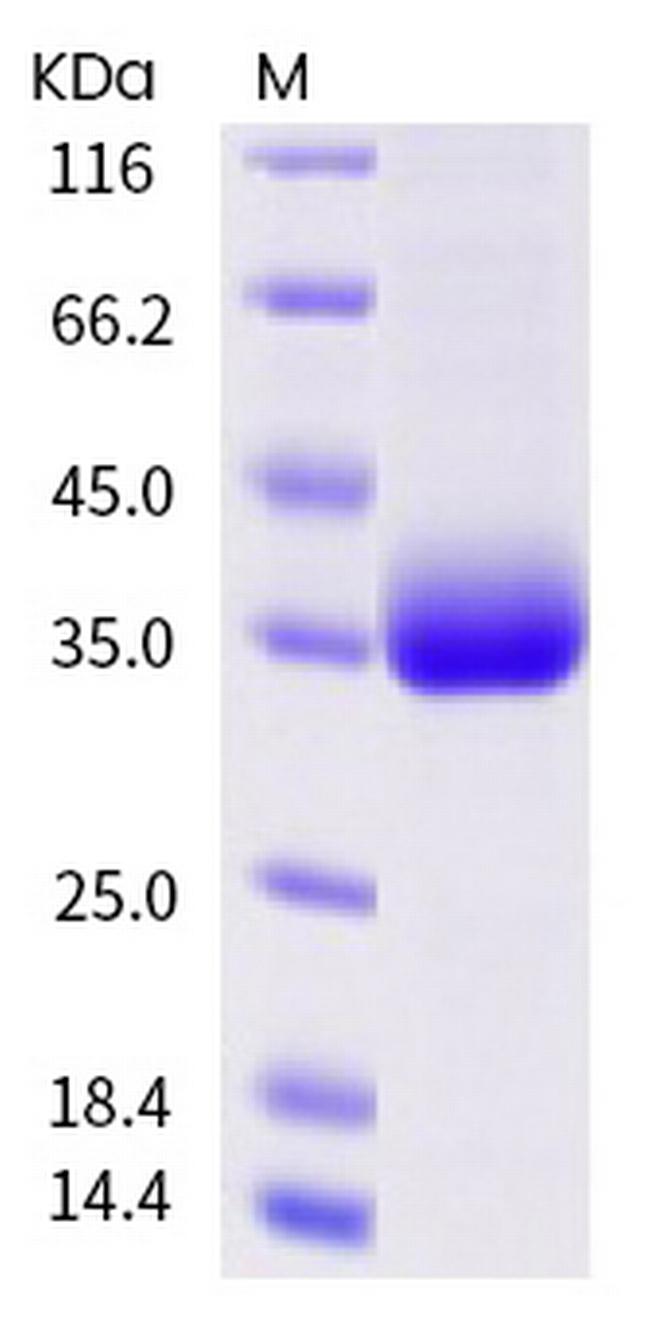 SARS-CoV-2 Spike Protein (RBD) (A522S) His-tag Protein