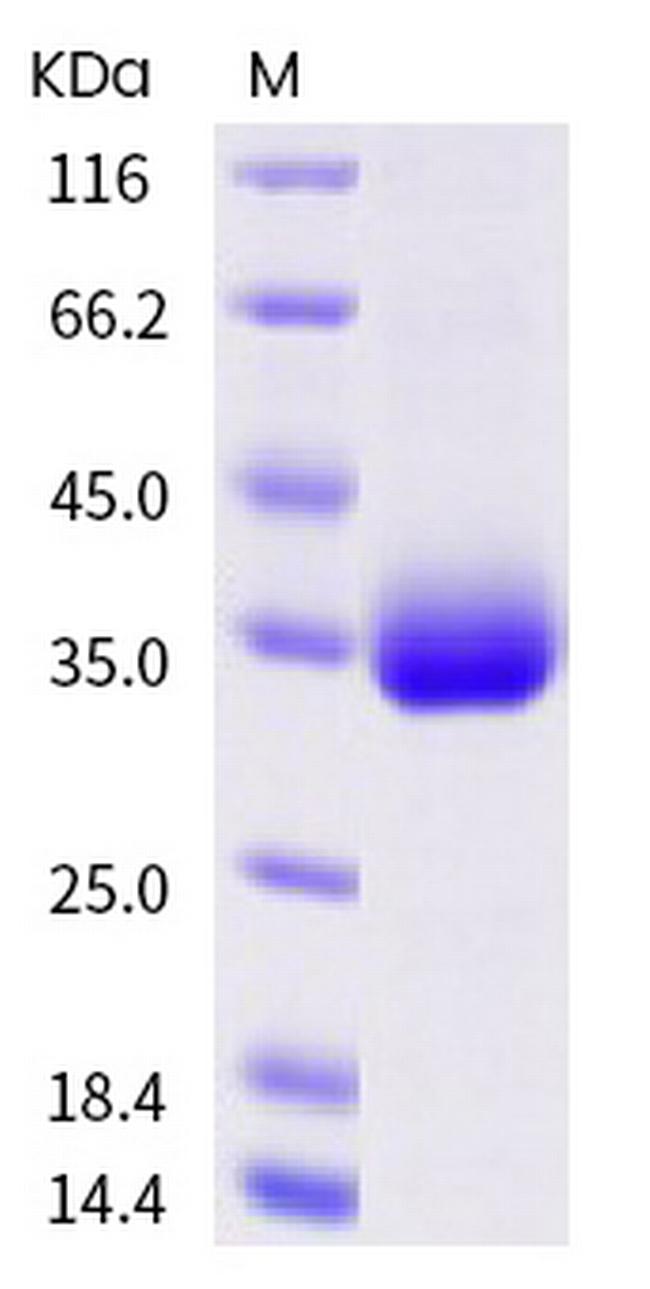 SARS-CoV-2 Spike Protein (RBD) (A522V) His-tag Protein