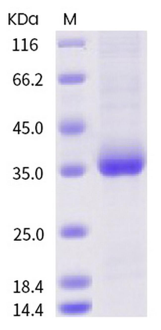 SARS-CoV-2 Spike Protein (RBD) (mutant) His-tag Protein