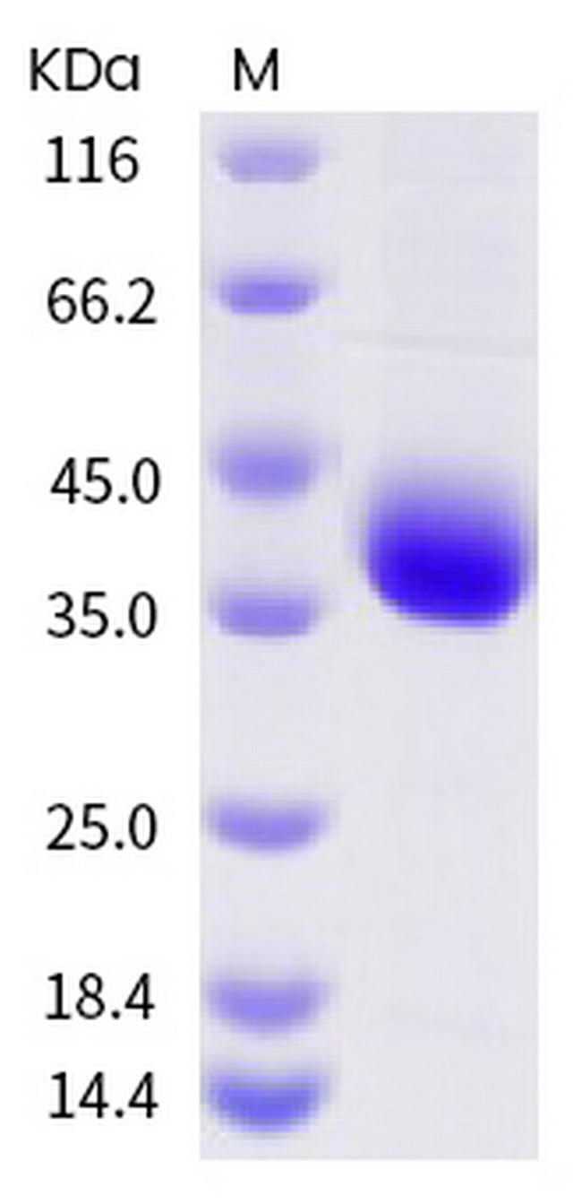 SARS-CoV-2 Spike Protein (RBD) (E406Q) His-tag Protein