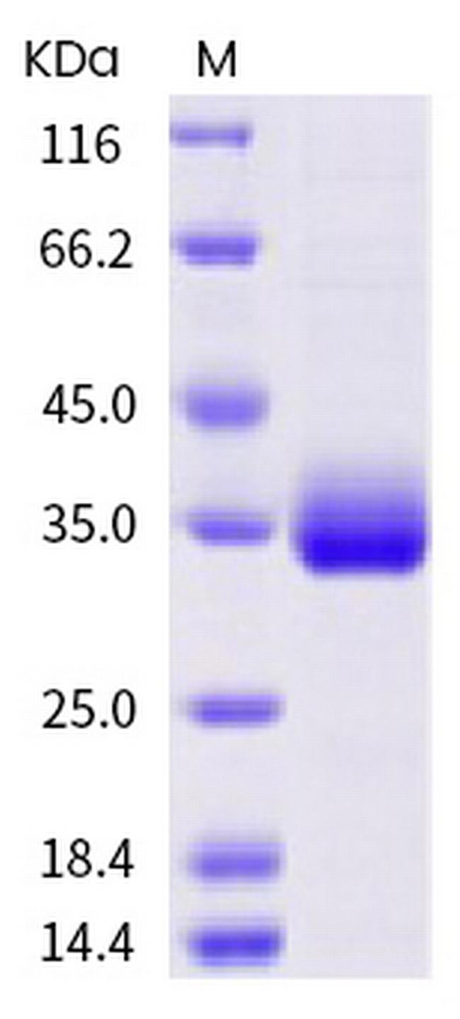 SARS-CoV-2 Spike Protein (RBD) (E471Q) His-tag Protein