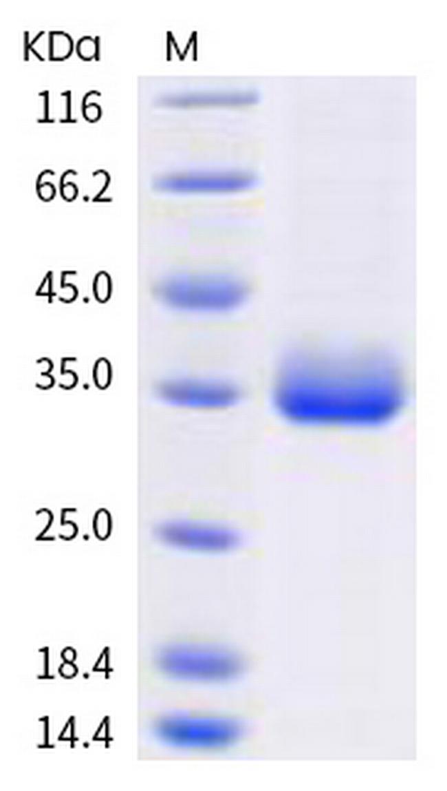 SARS-CoV-2 Spike Protein (RBD) (E484K) His-tag Protein