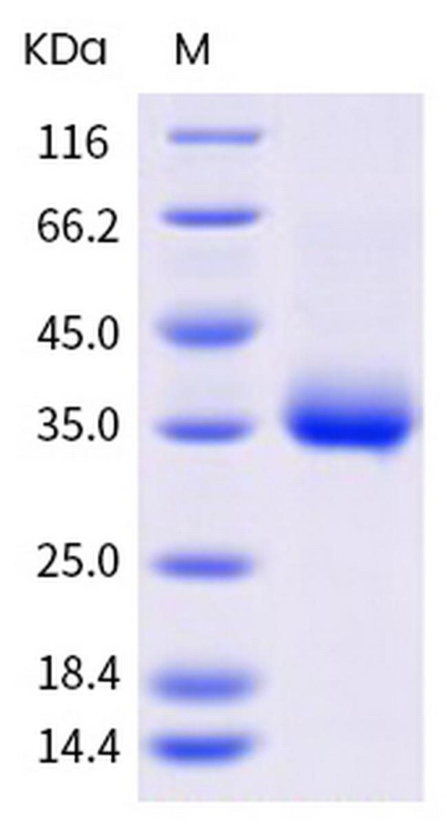 SARS-CoV-2 Spike Protein (RBD) (E484Q) His-tag Protein