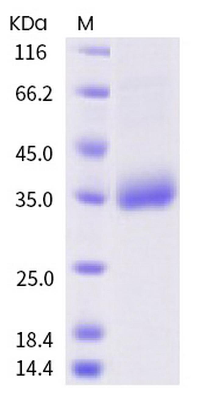 SARS-CoV-2 Spike Protein (RBD) (F338L) His-tag Protein