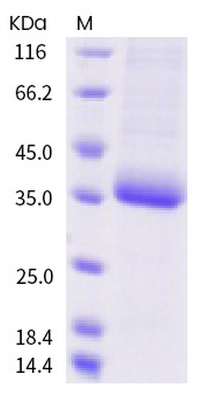 SARS-CoV-2 Spike Protein (RBD) (F377L) His-tag Protein