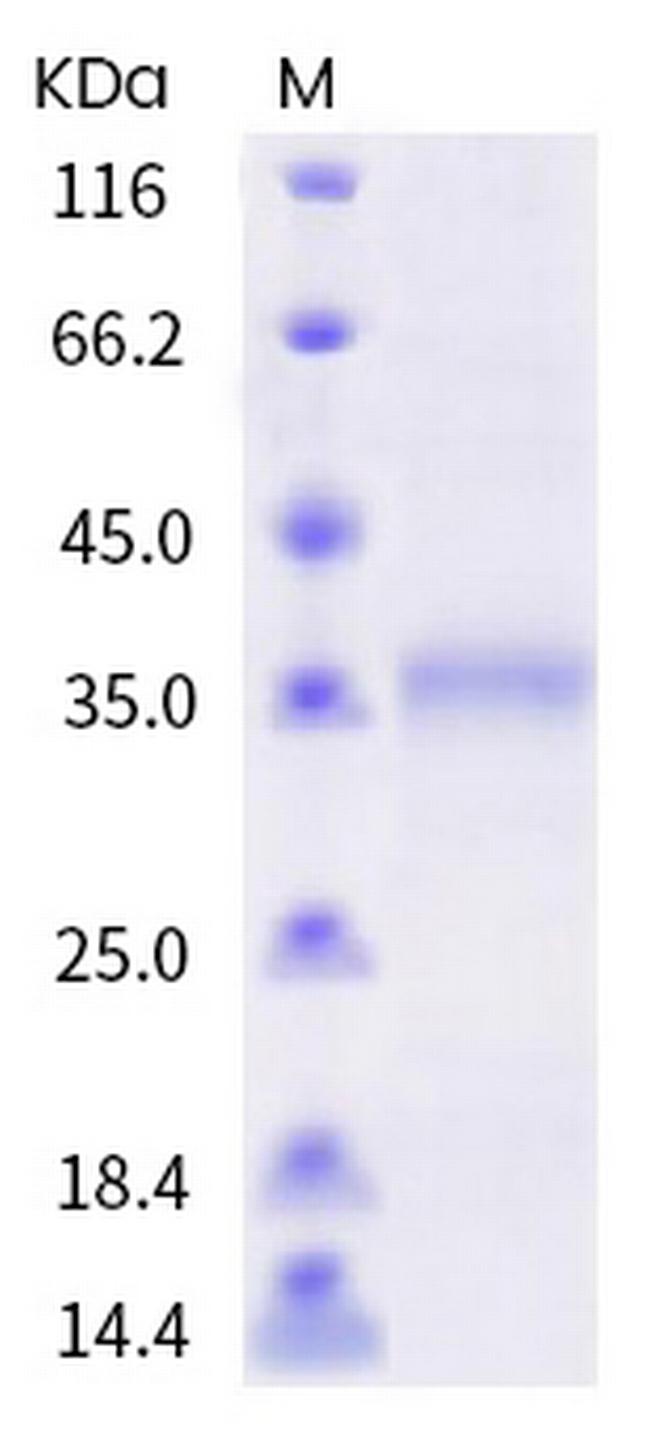 SARS-CoV-2 Spike Protein (RBD) (F456E) His-tag Protein