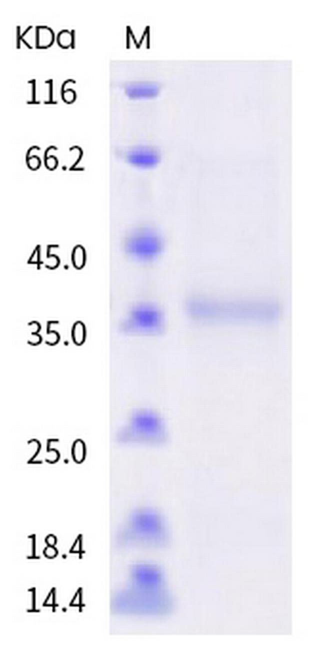 SARS-CoV-2 Spike Protein (RBD) (F456L) His-tag Protein