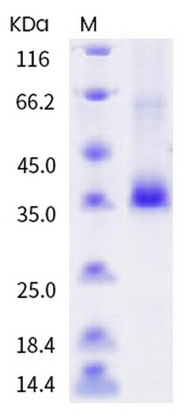 SARS-CoV-2 Spike Protein (RBD) (F486S) His-tag Protein