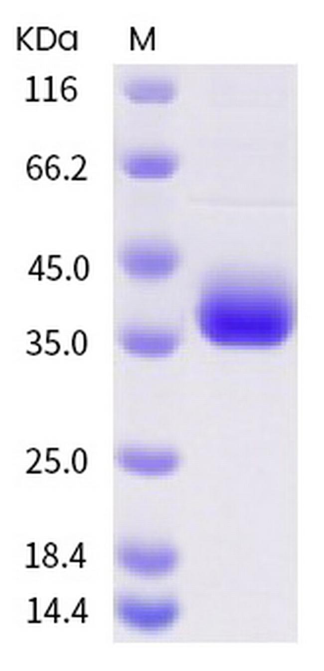 SARS-CoV-2 Spike Protein (RBD) (F490S) His-tag Protein