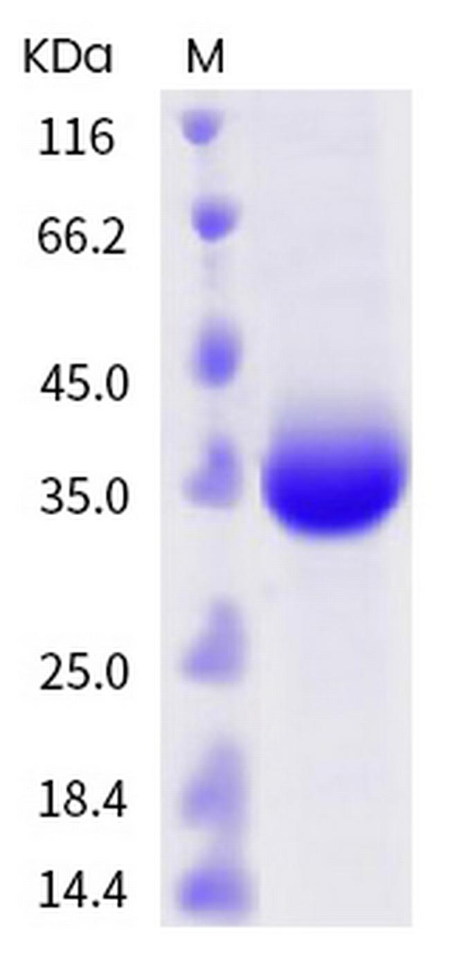 SARS-CoV-2 Spike Protein (RBD) (G446S) His-tag Protein