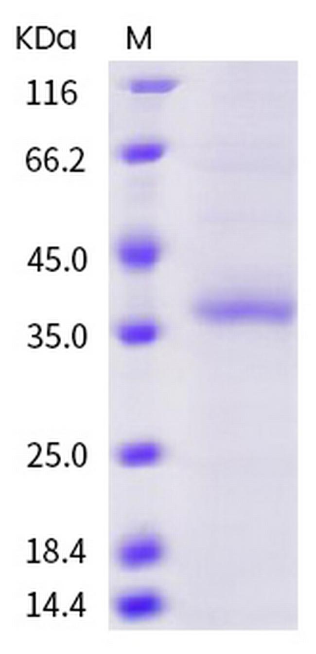 SARS-CoV-2 Spike Protein (RBD) (G446V) His-tag Protein