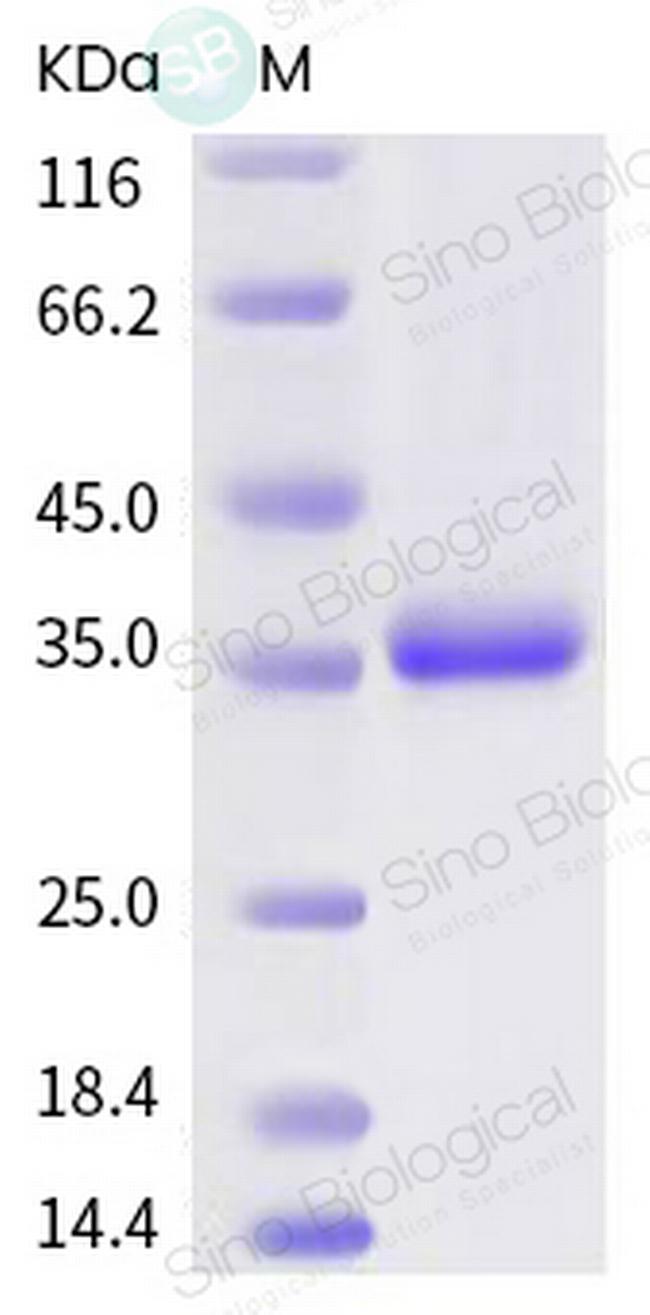 SARS-CoV-2 Spike Protein (RBD) (G476S) His-tag Protein