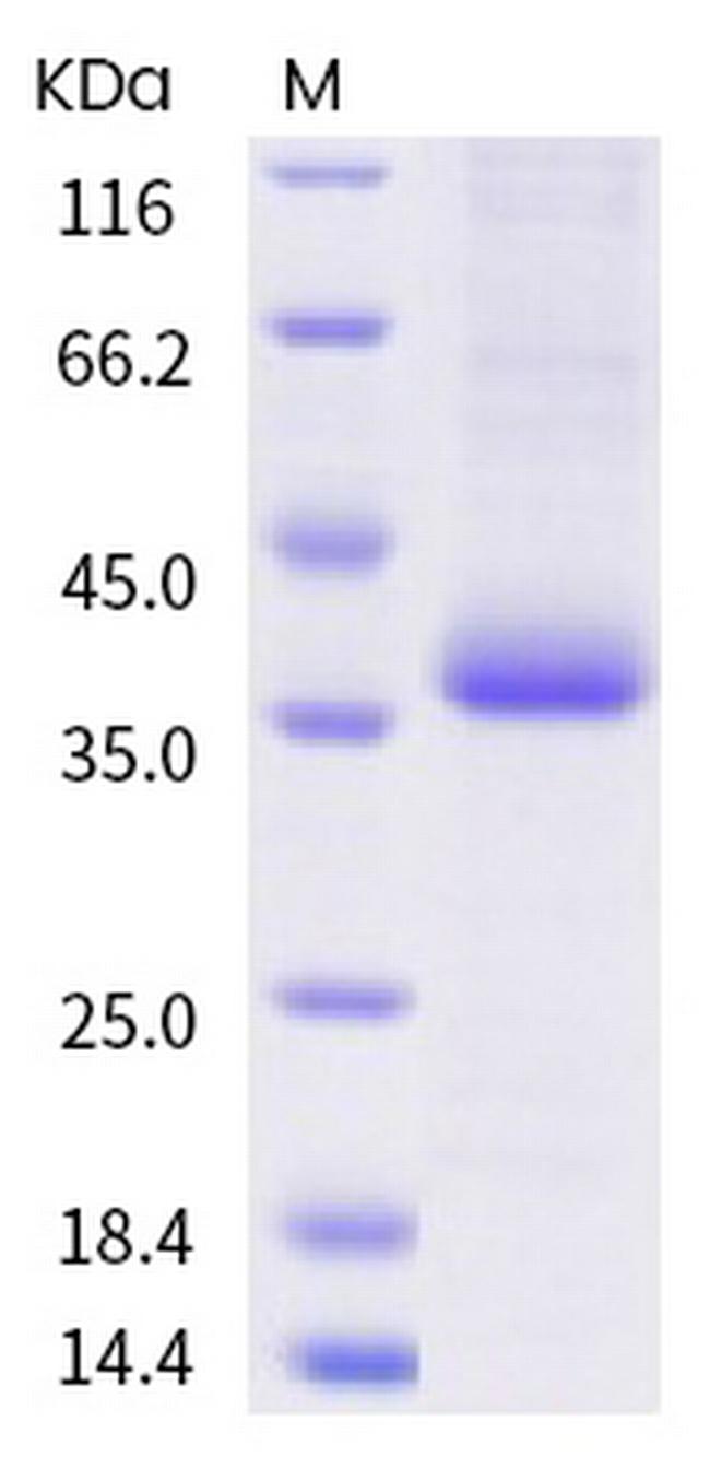 SARS-CoV-2 Spike Protein (RBD) (G482S) His-tag Protein