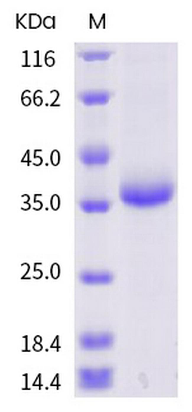 SARS-CoV-2 Spike Protein (RBD) (G485S) His-tag Protein