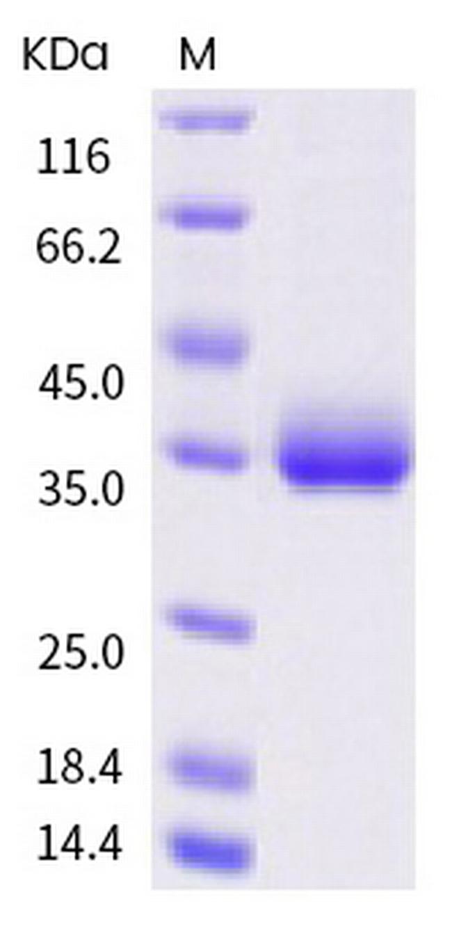 SARS-CoV-2 Spike Protein (RBD) (I472V) His-tag Protein