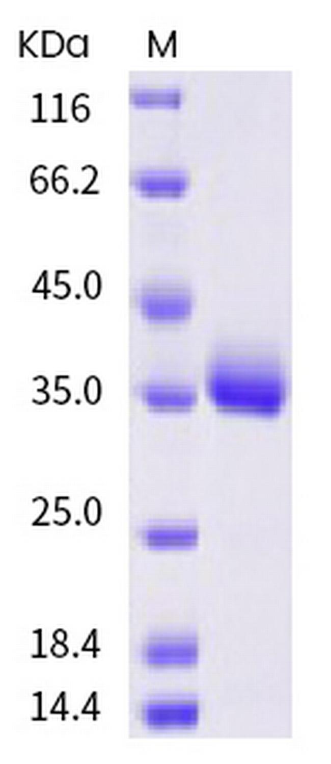 SARS-CoV-2 Spike Protein (RBD) (K378N) His-tag Protein