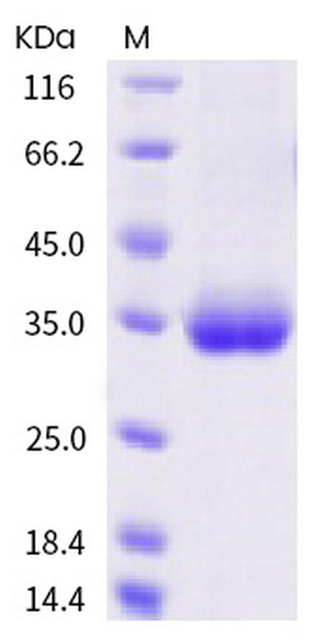 SARS-CoV-2 Spike Protein (RBD) (K378R) His-tag Protein