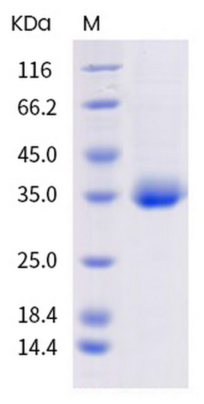 SARS-CoV-2 Spike Protein (RBD) (mutant) His-tag Protein