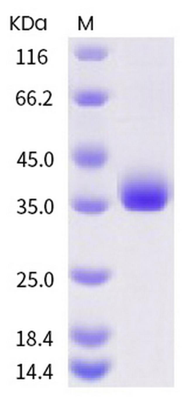 SARS-CoV-2 Spike Protein (RBD) (K444R) His-tag Protein